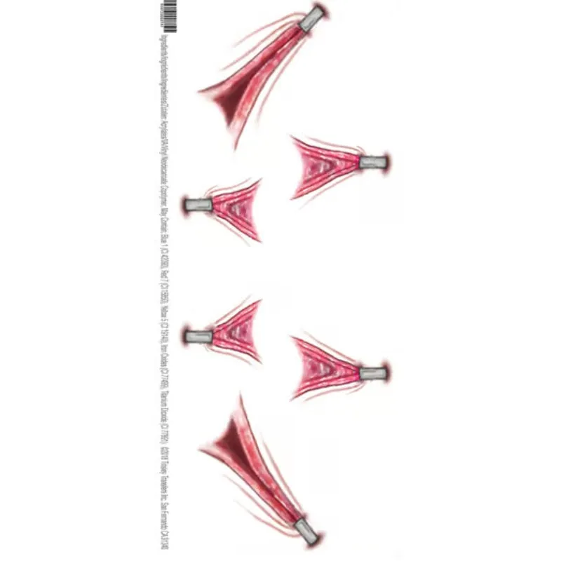 Tinsley FX Temp Tattoo - Stretched